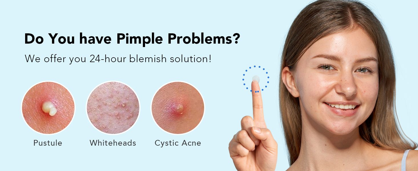 do you have pimple problems