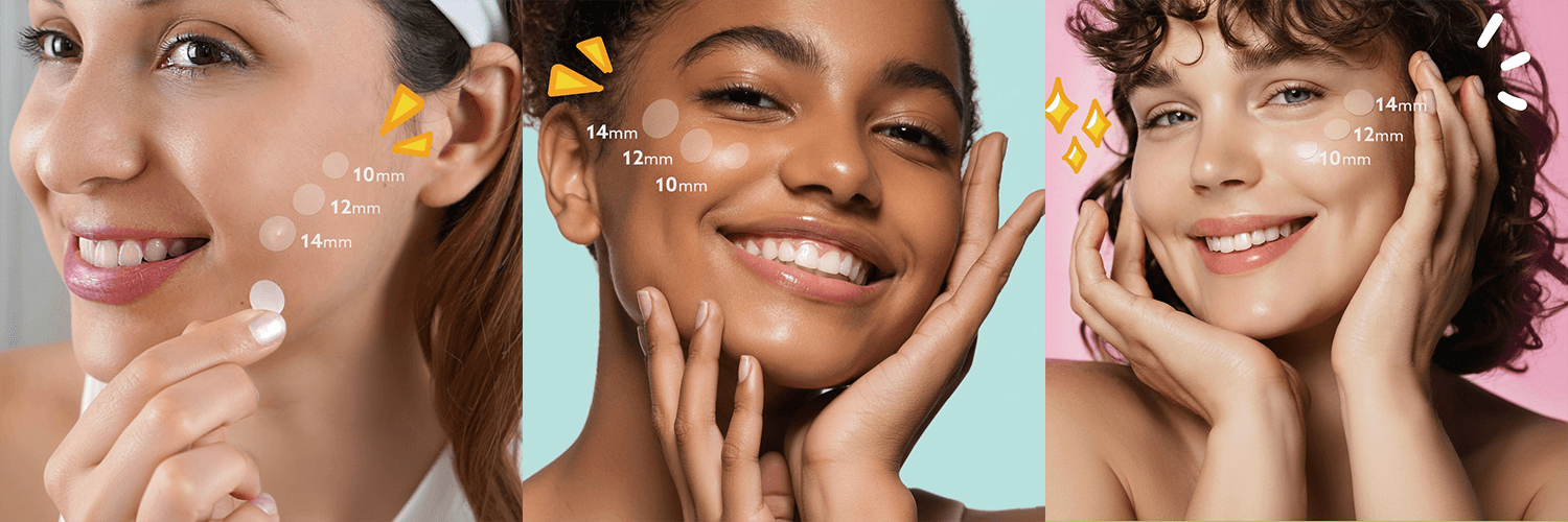 Veilta pimple patch OEM/ODM manufacturing for skincare brands Close-up of pimple patches on skin