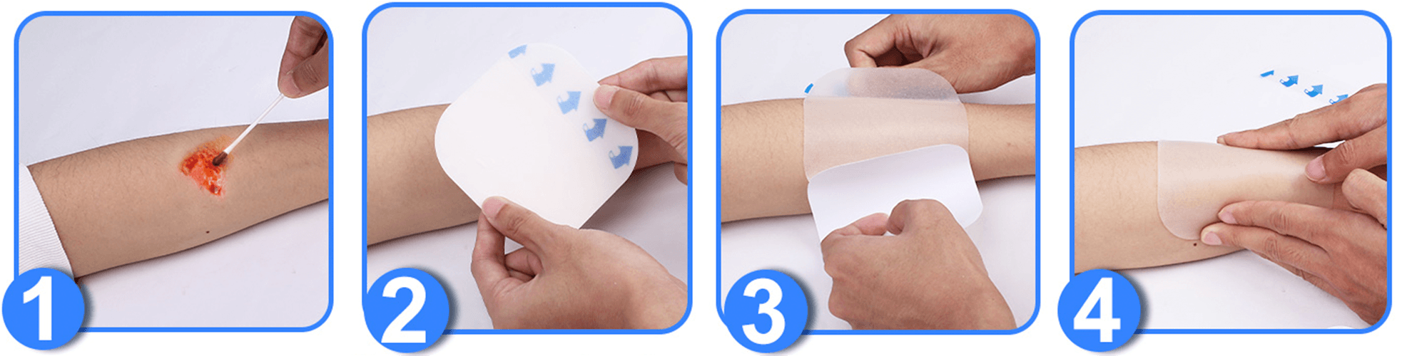 Steps to apply hydrocolloid dressing